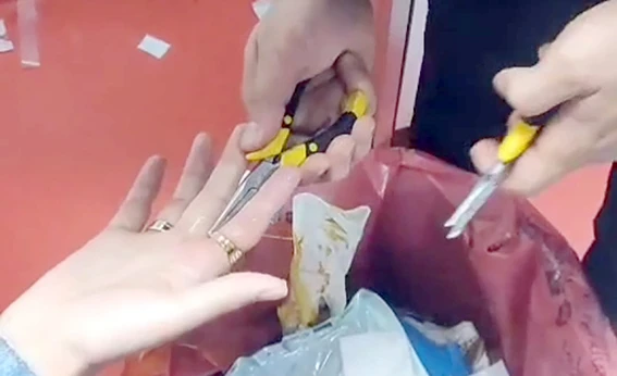 YÜZÜĞÜ PARMAĞINDAN ÇIKARAMADI, İTFAİYE YETİŞTİ!