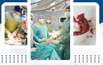 BATMAN'DA BİR İLK: WHİPPLE PROSED&Uuml;R&Uuml; BAŞARIYLA GER&Ccedil;EKLEŞTİRİLDİ