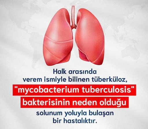 “SESSİZ TEHLİKE VEREM HÂLÂ TEHDİT OLUŞTURUYOR”